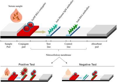 Development of a Gold Nanoparticle-Based Lateral-Flow Immunoassay for Pneumocystis Pneumonia Serological Diagnosis at Point-of-Care